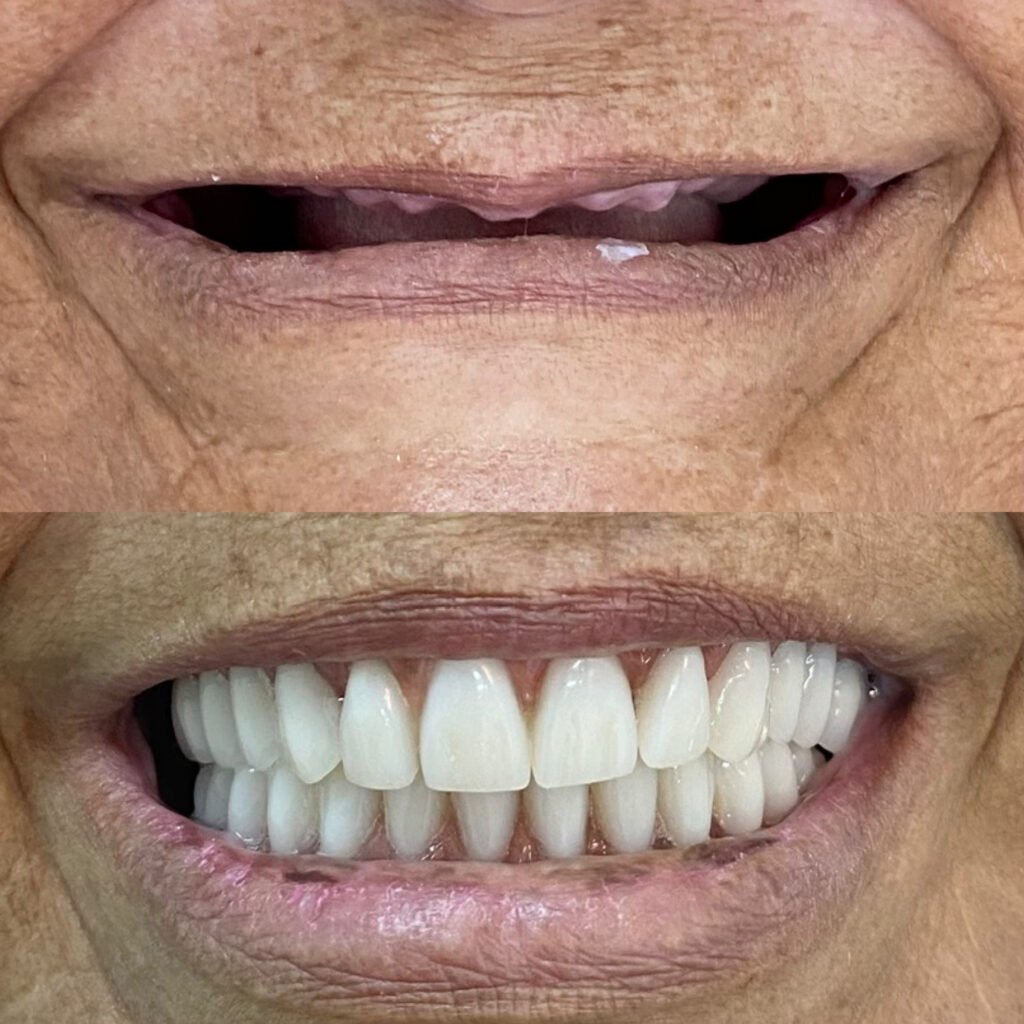 02-ANTES-E-DEPOIS-19.05